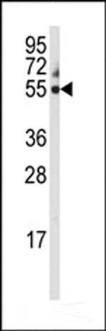 CYP3A5 Antibody in Western Blot (WB)