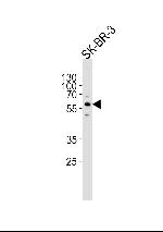 CYP3A5 Antibody in Western Blot (WB)