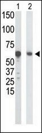 GCK Antibody in Western Blot (WB)