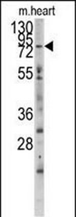 MLCK Antibody in Western Blot (WB)