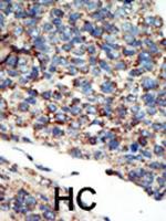 PIK3C2G Antibody in Immunohistochemistry (Paraffin) (IHC (P))