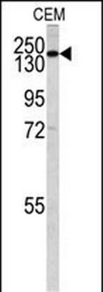 PIK3C2G Antibody in Western Blot (WB)