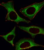 PIK3CD Antibody in Immunocytochemistry (ICC/IF)