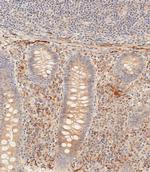 PIK3CD Antibody in Immunohistochemistry (Paraffin) (IHC (P))