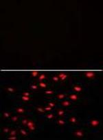 PI4K2A Antibody in Immunocytochemistry (ICC/IF)