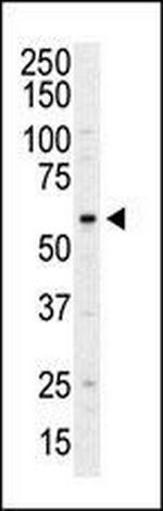 PI4K2A Antibody in Western Blot (WB)