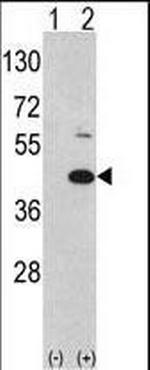 MOS Antibody in Western Blot (WB)