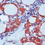 Calcitonin Antibody in Immunohistochemistry (Paraffin) (IHC (P))