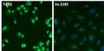 Estrogen Receptor alpha Antibody