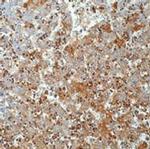 AFP Antibody in Immunohistochemistry (Paraffin) (IHC (P))