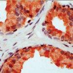 CD178 Antibody in Immunohistochemistry (IHC)