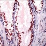 Androgen Receptor Antibody in Immunohistochemistry (IHC)