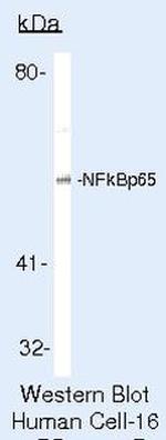 NFkB p65 Antibody in Western Blot (WB)
