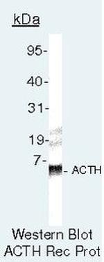 ACTH Antibody in Western Blot (WB)