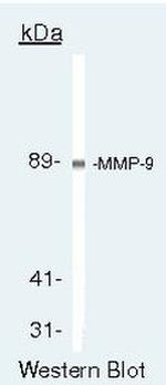 MMP9 Antibody in Western Blot (WB)