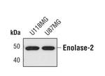 NSE Antibody in Western Blot (WB)