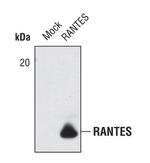 CCL5 (RANTES) Antibody in Western Blot (WB)