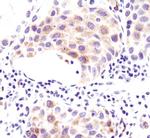 ACSL1 Antibody in Immunohistochemistry (Paraffin) (IHC (P))