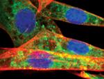 ATG12 Antibody in Immunocytochemistry (ICC/IF)