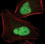 JunB Antibody in Immunocytochemistry (ICC/IF)