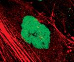 SETD7 Antibody in Immunocytochemistry (ICC/IF)