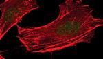 Phospho-RSK1 (Thr573) Antibody in Immunocytochemistry (ICC/IF)