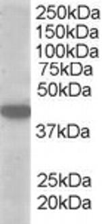 MCT2 Antibody in Western Blot (WB)