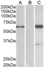 BAIAP2 Antibody in Western Blot (WB)