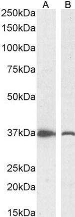 DDAH1 Antibody in Western Blot (WB)