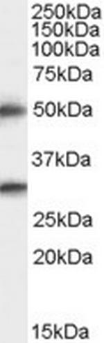 Spinesin Antibody in Western Blot (WB)