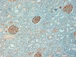 NQO1 Antibody in Immunohistochemistry (Paraffin) (IHC (P))