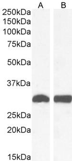 NQO1 Antibody in Western Blot (WB)