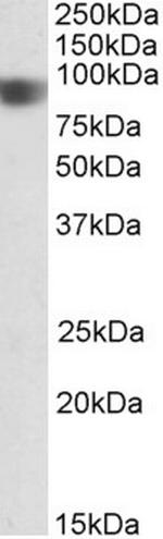 NOD1 Antibody in Western Blot (WB)