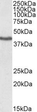 KLF3 Antibody in Western Blot (WB)