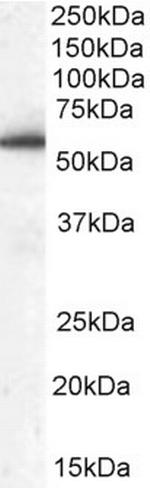 HIP55 Antibody in Western Blot (WB)