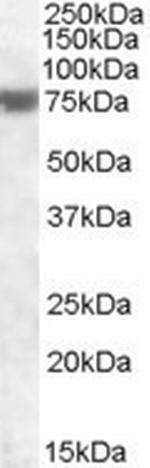 FEM1A Antibody in Western Blot (WB)