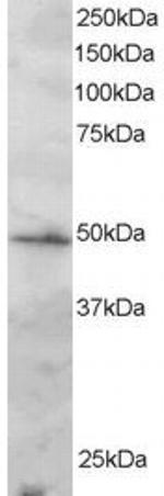 IRF2 Antibody in Western Blot (WB)