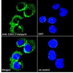 NLRP3 Antibody in Immunocytochemistry (ICC/IF)