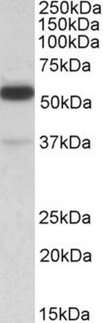 TRIM5 alpha/gamma/delta Antibody in Western Blot (WB)