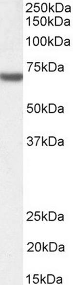 FANCG Antibody in Western Blot (WB)