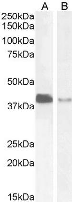 PAR6 Antibody in Western Blot (WB)