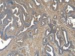 VPS35 Antibody in Immunohistochemistry (Paraffin) (IHC (P))