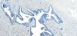 VPS35 Antibody in Immunohistochemistry (Paraffin) (IHC (P))