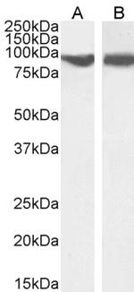 VPS35 Antibody in Western Blot (WB)