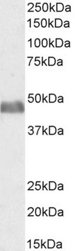BAF53A/BAF53B Antibody in Western Blot (WB)