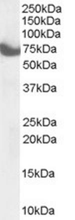 ZDHHC17 Antibody in Western Blot (WB)