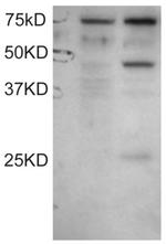 DYX1C1 Antibody in Western Blot (WB)