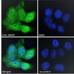 WASP Antibody in Immunocytochemistry (ICC/IF)