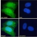 WASP Antibody in Immunocytochemistry (ICC/IF)