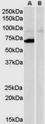 MAOA Antibody in Western Blot (WB)